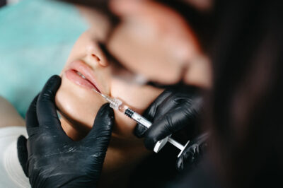 Контурна пластика губ, збільшення губ Житомир