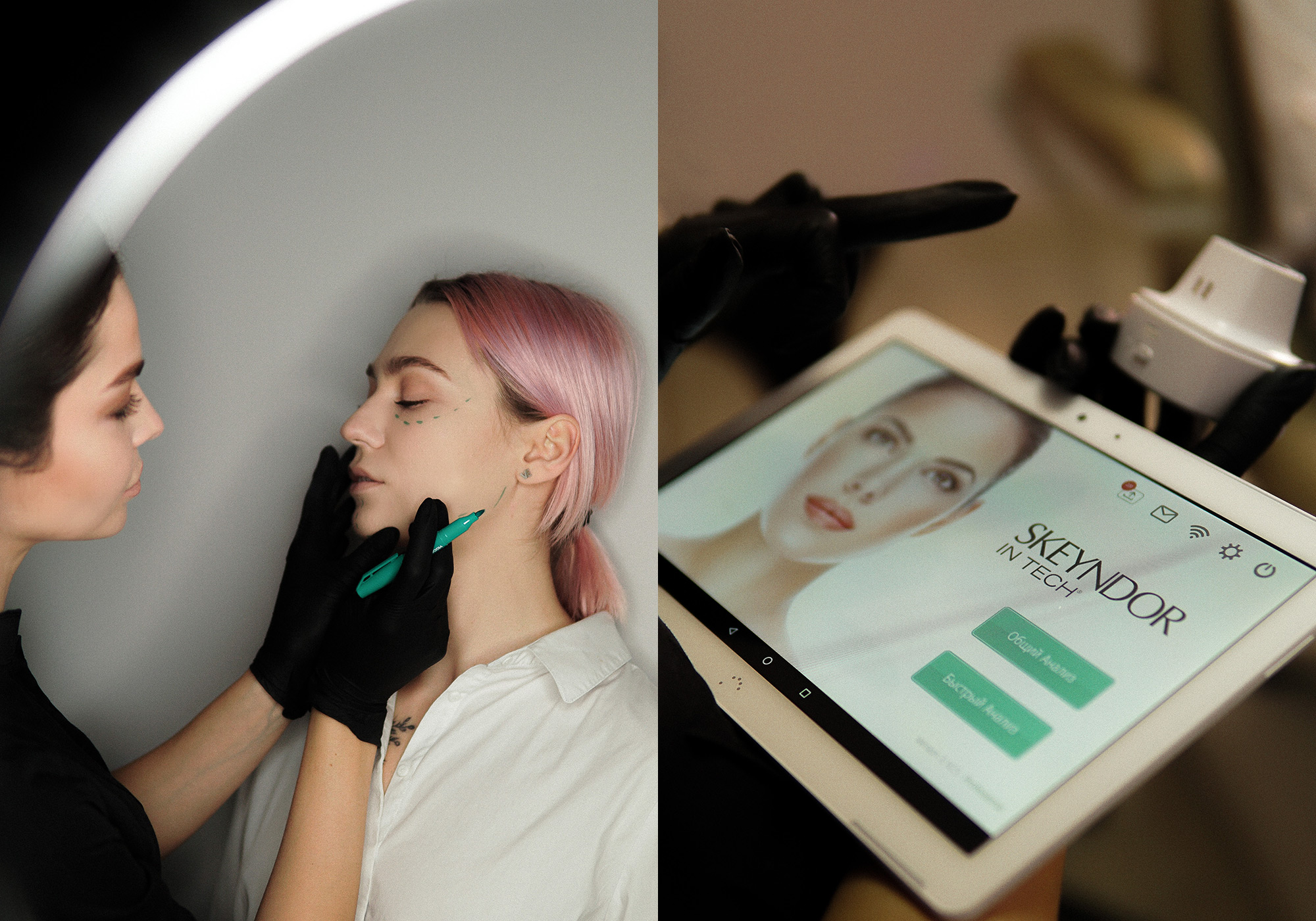 ДІАГНОСТИКА ШКІРИ SKIN SMART DIAGNOSIS